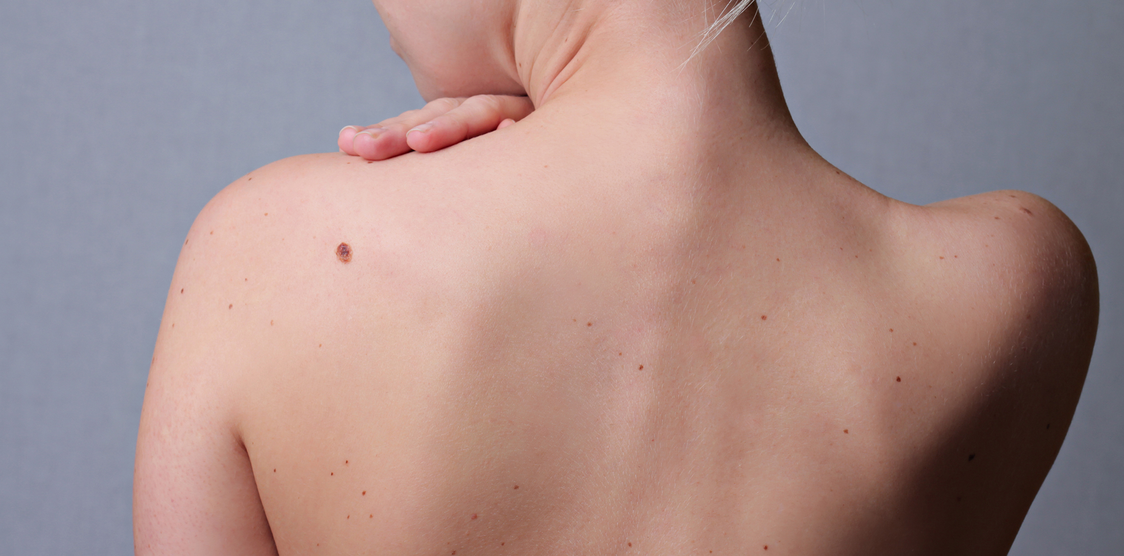 Moles