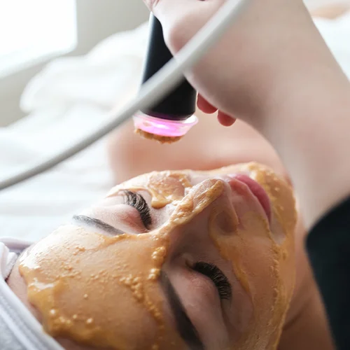 Medical Spa in Calgary 1 Medical grade facial at SKIN Clinics 3 SKIN Clinics