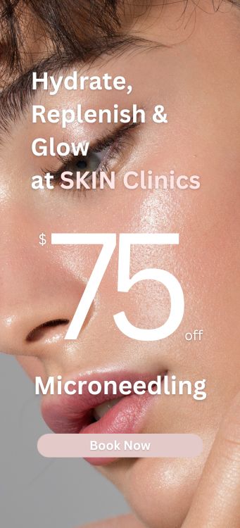 Microneedling Promo 75 off mobile SKIN Clinics