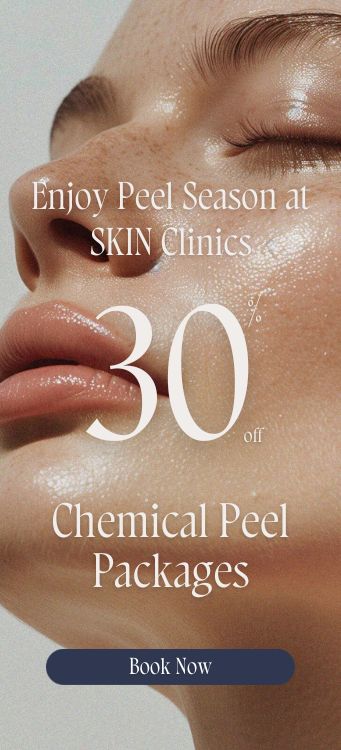 Chemical peel mobile