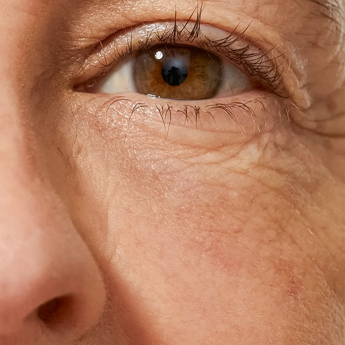 Understanding Wrinkles: Causes, Prevention, and Management