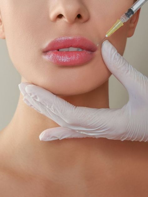 Lip Fillers in Bank View Calgary 1 3b88511ab2a6b5d2b1cc20ac426a8094 SKIN Clinics
