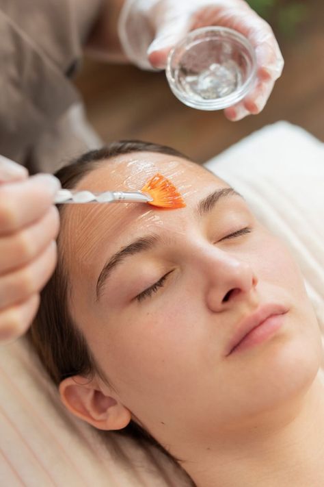Chemical peel SKIN Clinics