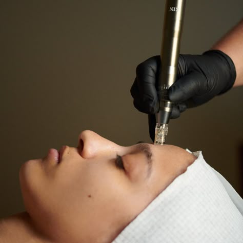 Microneedling SKIN Clinics