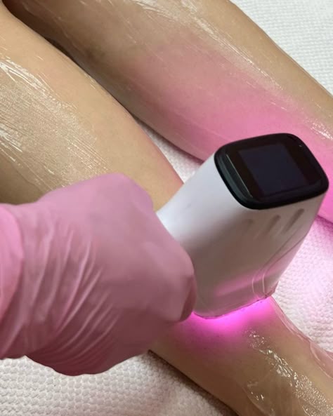 laser removal benefit 2 SKIN Clinics