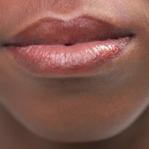 Chin Dimpling Treatment SKIN Clinics