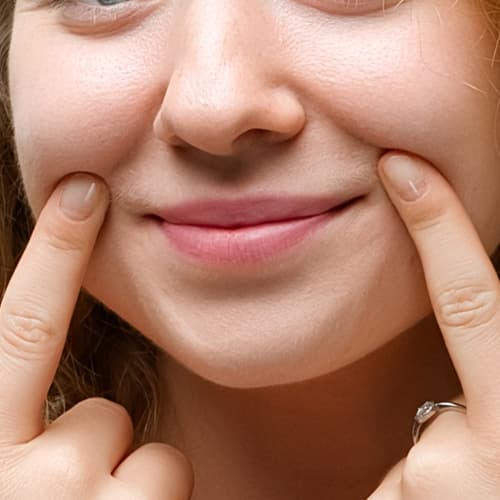 Smile line softening SKIN Clinics